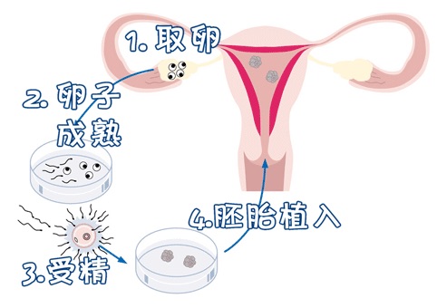 有偿孕妈借卵代怀咨询微信群